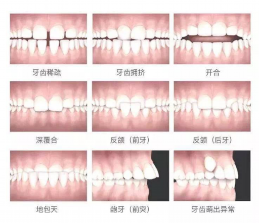 【儿牙常见问题】儿童涂氟在家做和到口腔医院有什么区别，哪个好